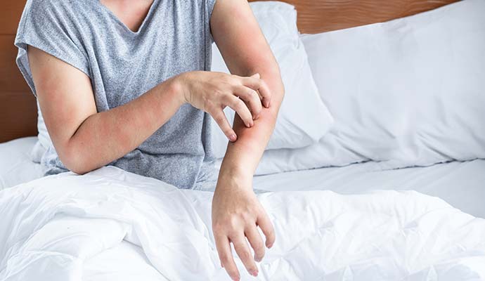 Woman affected by allergy problem